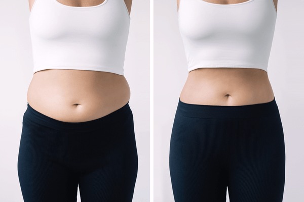 10,712 Before After Weight Loss Royalty-Free Images, Stock Photos & Pictures | Shutterstock 10,712 Before After Weight Loss Royalty-Free Images, Stock Photos & Pictures | Shutterstock